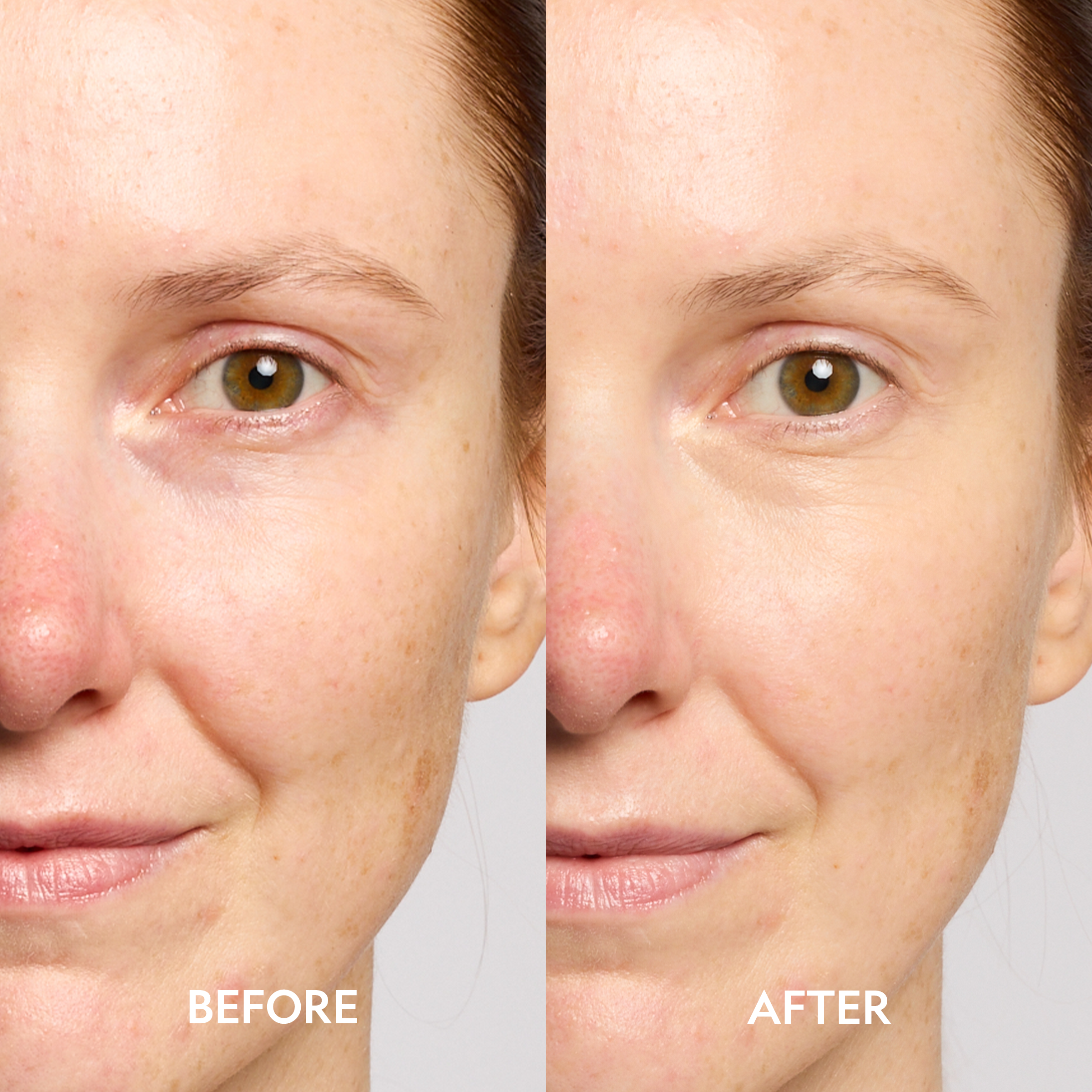 Super Bright Dark Circle Serum Peptide Corrector